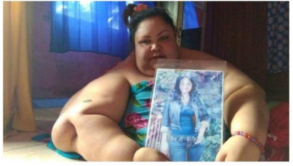 Konsumsi Gorengan, Badan Gemuk, Berat Naik Jadi 350 Kg