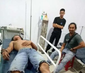 Hendak Melarikan Diri, Timah Panas Bersarang di Betis