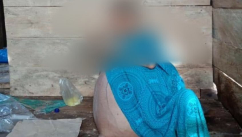 Perut Membesar, Ibu Muda ini Belum Ditangani Medis