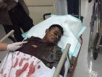Salah seorang korban bom bunu diri dari anggota Kepolisian mendapat perawatan intensif. FOTO : INT