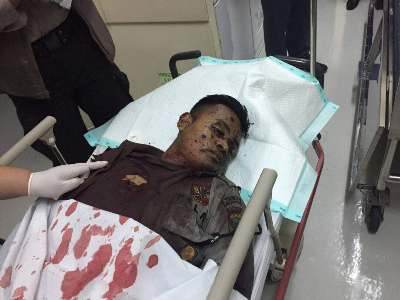 Salah seorang korban bom bunu diri dari anggota Kepolisian mendapat perawatan intensif. FOTO : INT