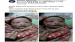 Ibu Alami Penyulitan, Bayi Lahir Penuh Memar di Wajah