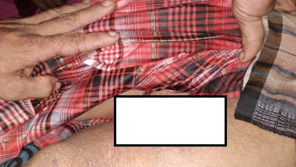 Digigit Buaya Sekitar Kemaluan, Pengusaha Kayu di Butur Tewas ﻿