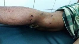 Warga Bonea Kabupaten Muna Digigit Buaya Saat Mandi di Danau Sangia