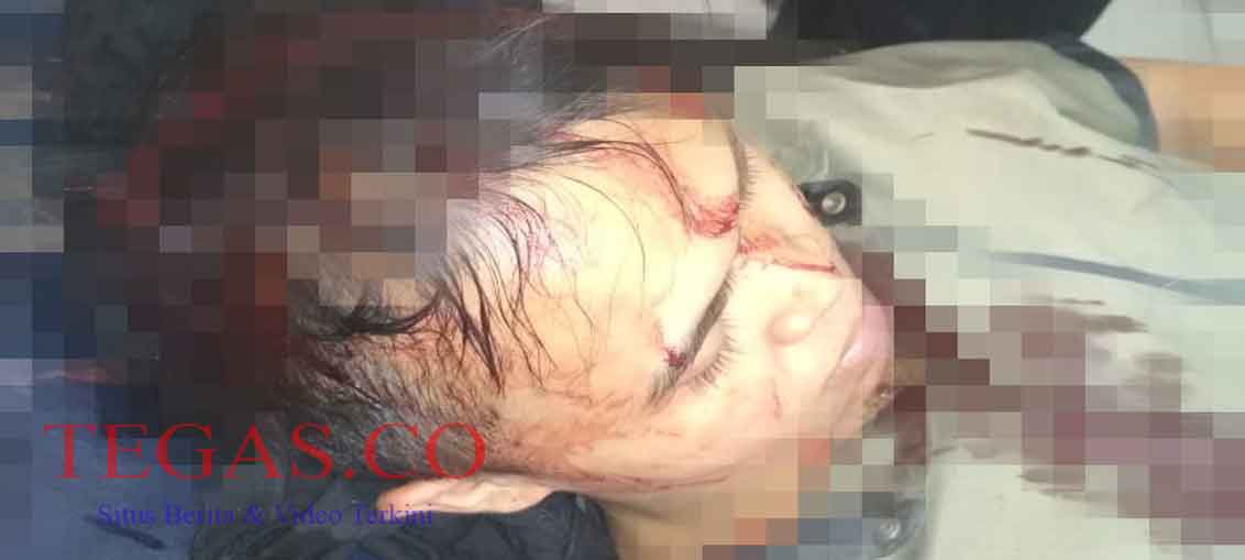 Dibakar Api Cemburu, Seorang Pemuda Nekad Aniaya Teman Istrinya