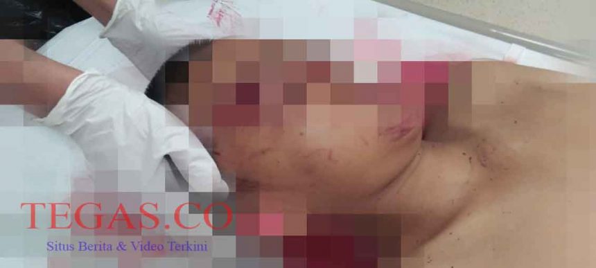 Tawuran Pelajar di Kembangan Kembali Memakan Korban Jiwa