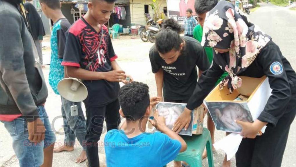 Bupati Buteng Diminta Bantu Biaya Pengobatan Bayi Kembar Siam Asal Desa Lolibu