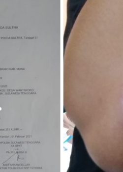 Tanpa Sebab, Oknum Plt Desa Wantiworo Diduga Aniaya Warganya