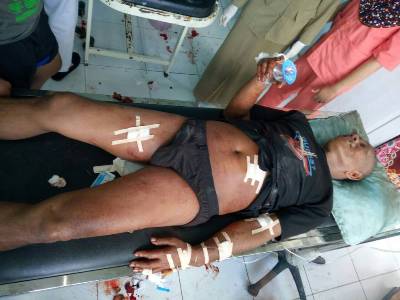 Korban lainnya yang juga mengalami luka-luka akibat perkelahian dengan senjata tajam di atas kapal. FOTO ; SUDIRMAN
