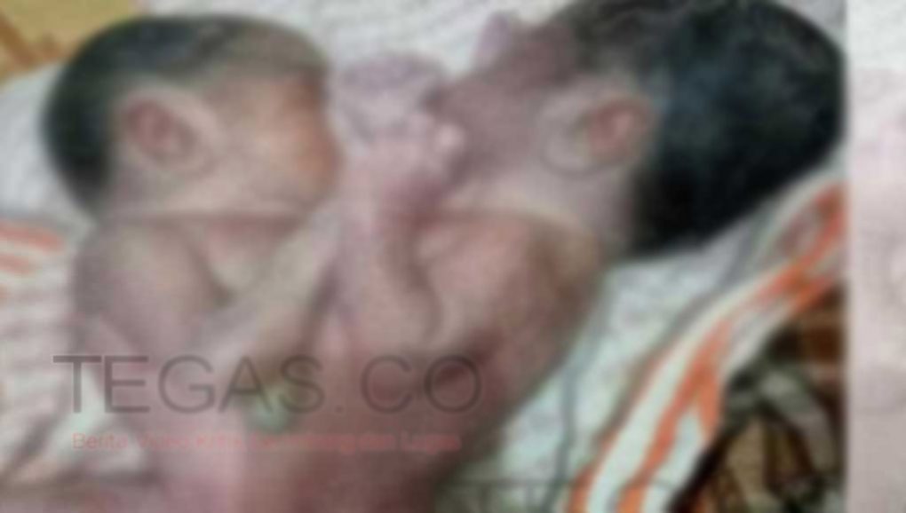 Tak Sempat Dirujuk ke Makassar, Bayi Kembar Siam Asal Buteng Tutup Usia di Palagimata