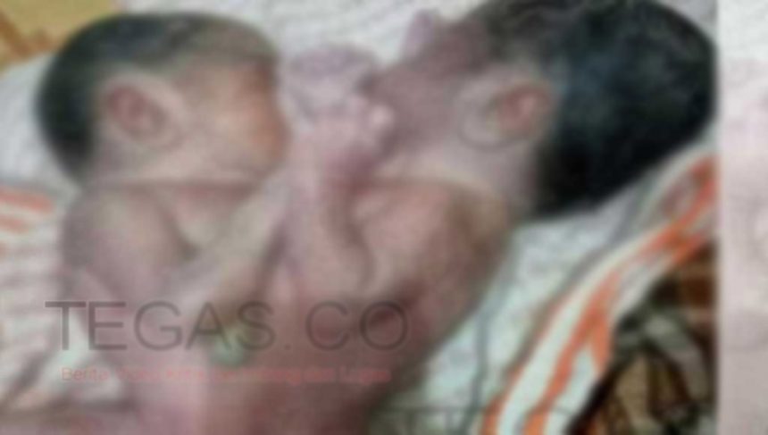 Tak Sempat Dirujuk ke Makassar, Bayi Kembar Siam Asal Buteng Tutup Usia di Palagimata