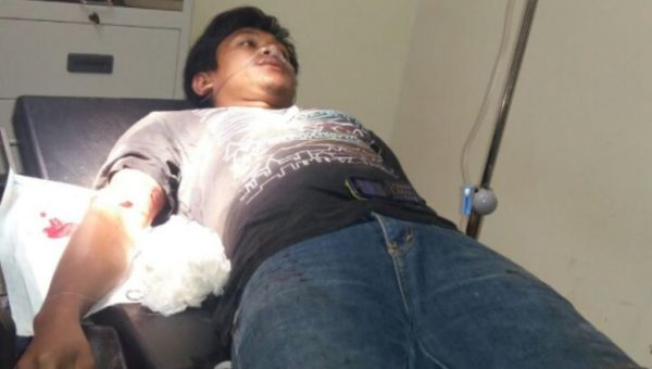 Duh, Bukannya Ayam Dipotong, Malah Memotong Teman Sendiri