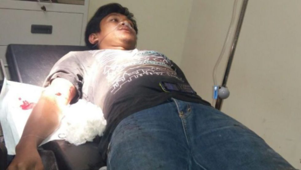 Duh, Bukannya Ayam Dipotong, Malah Memotong Teman Sendiri