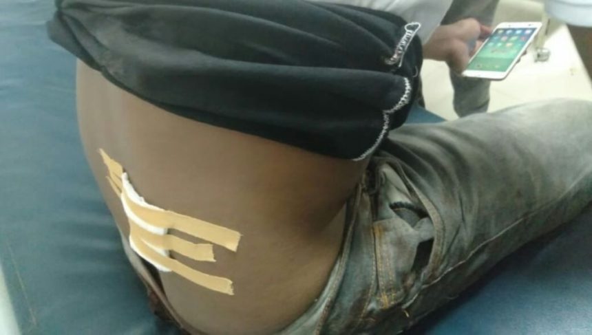 Seorang Warga Muna Ditikam Setelah dari Konter Handphone﻿