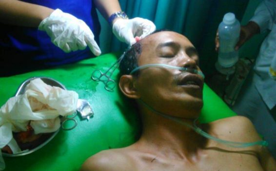 Wartawan ini mengalami luka setelah di hantamkan balok oleh tetangganya sendiri atas nama Ramlah. FOTO : ROBY SINAGA