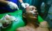 Wartawan ini mengalami luka setelah di hantamkan balok oleh tetangganya sendiri atas nama Ramlah. FOTO : ROBY SINAGA