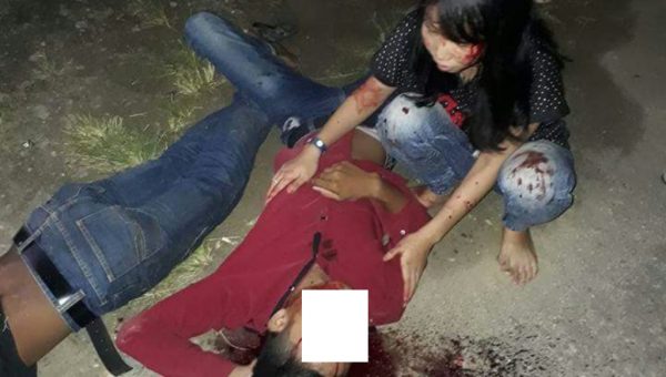 Tabrakan, Empat Pemuda Kritis Alami Luka Bagian Ini