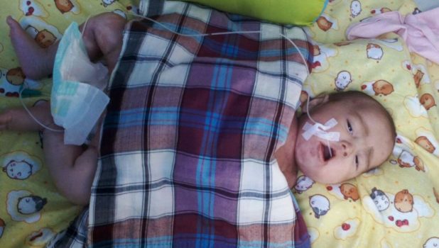 Konsumsi Susu Kaleng, Balita 4 Bulan Dirawat Intensif di RS Bahteramas